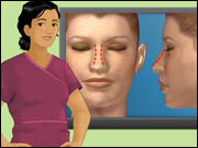 Virtual Nose Job